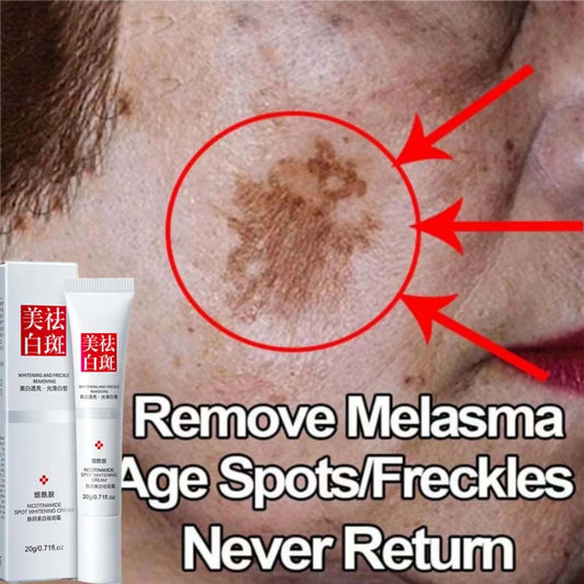 Effective Whiten Cream Brighten Face For Face Spots Remove Dark Spot Melasma Anti-pigmentation Improve Dullness Skin Care Cream